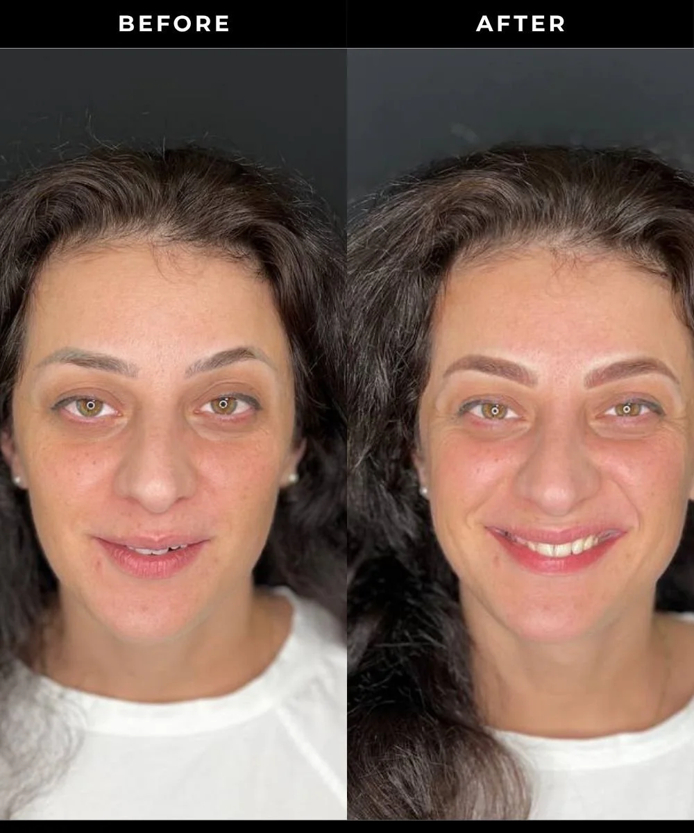Side-by-side comparison of a woman before and after permanent makeup, showing improvements eyebrows and appearance.
