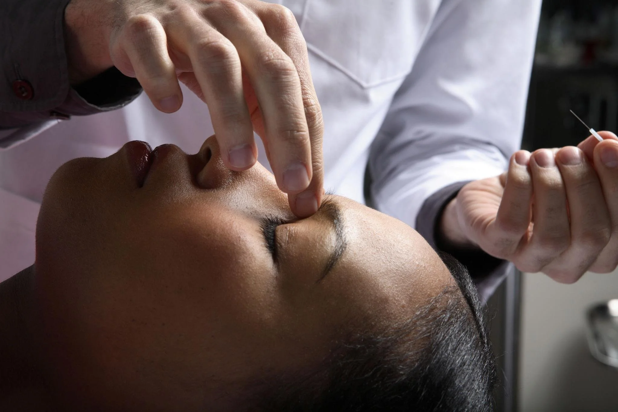 how acupuncture helps