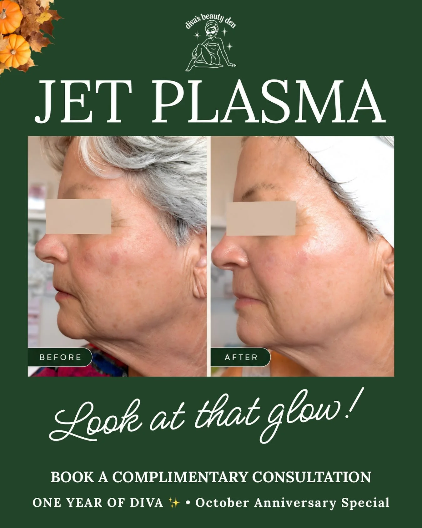 ✨ Look at that glow! ✨

This is why I love sharing real client results. Every skin journey is different, and my goal is always to create a treatment plan based on your skin, your concerns, and what you&rsquo;re hoping to achieve.

This beautiful befo