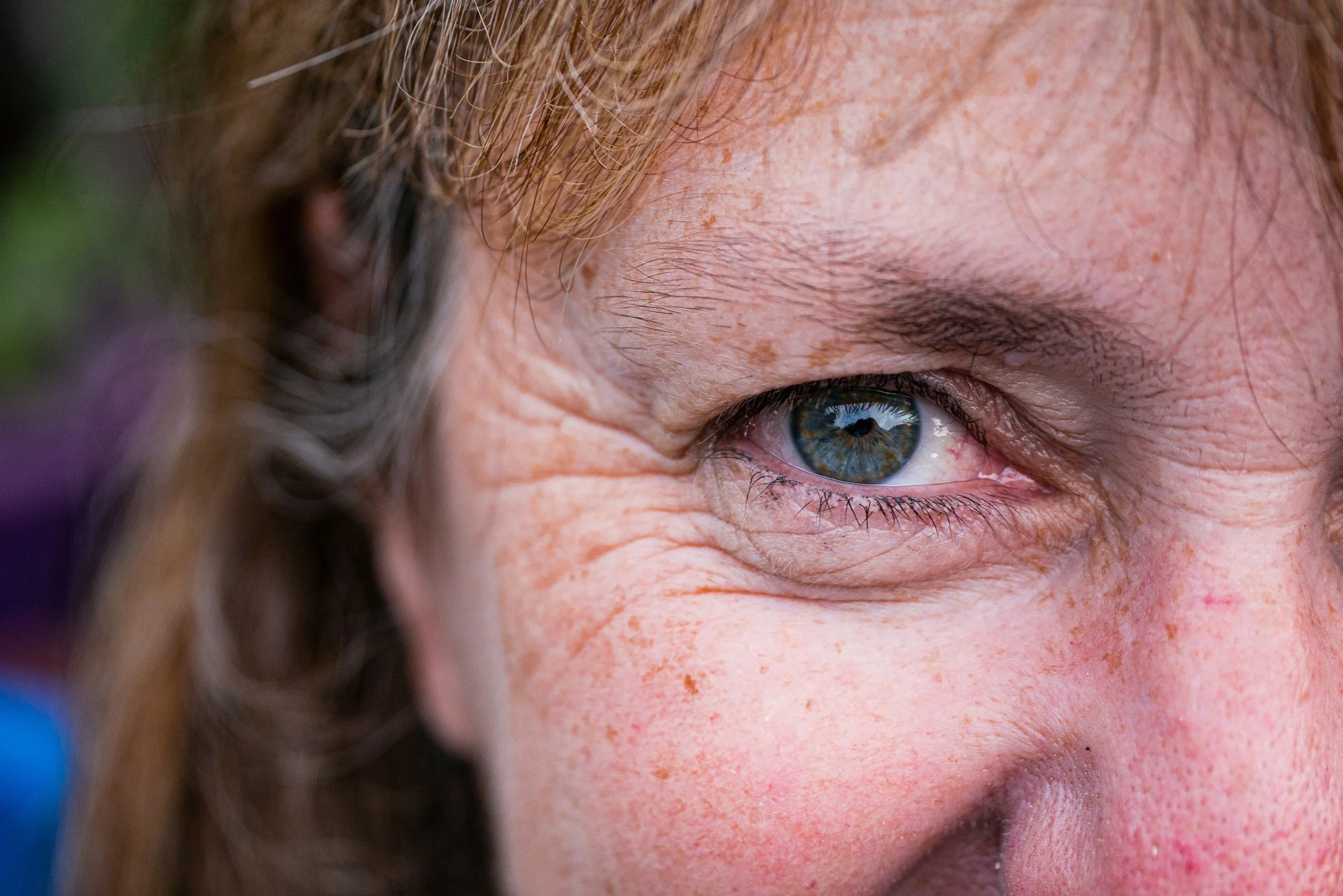 Close-up of a person's right eye, showing blue iris, light eyelashes, and freckles on their skin.