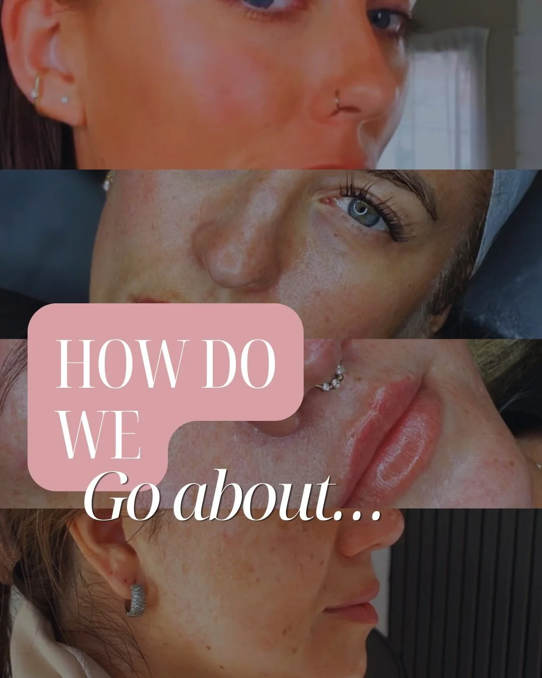 🔥 How do we choose the right skin booster for you?

1-  We assess your face and skin quality.
2-  We identify your concerns and what your skin needs.
3- We select the right treatment based on its ingredients, formulation and intended results.

Becau