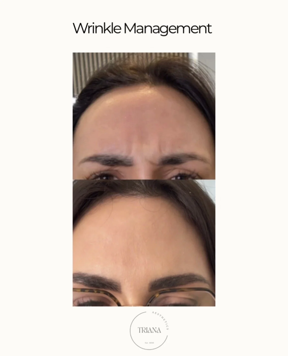 A promotional image showing the progression of wrinkle management treatments, with before, during, and after photos of a woman's forehead, and the logo for Triana Aesthetics at the bottom.