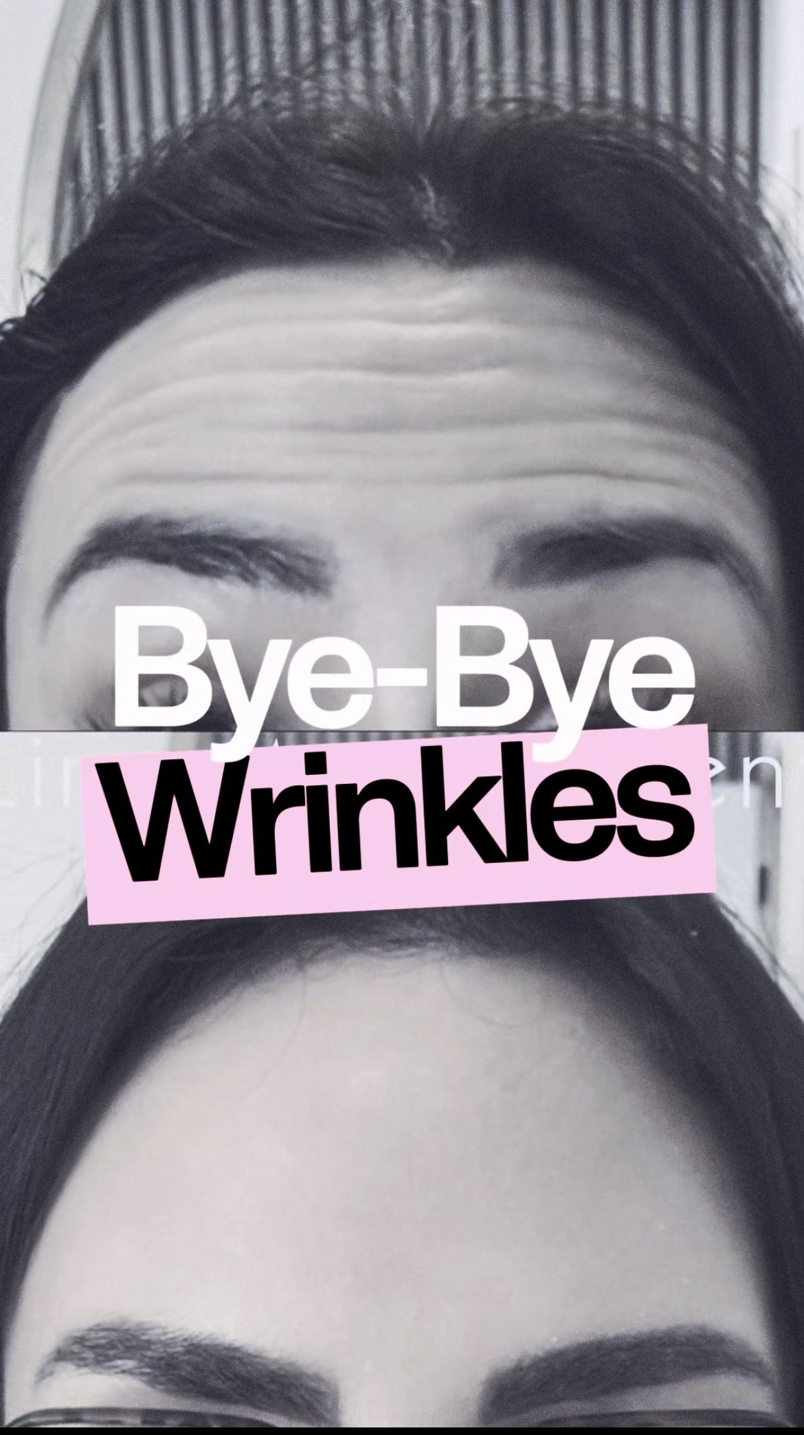 Close-up of a person's forehead and eyebrows with the text "Bye-Bye Wrinkles" overlaid on the image.