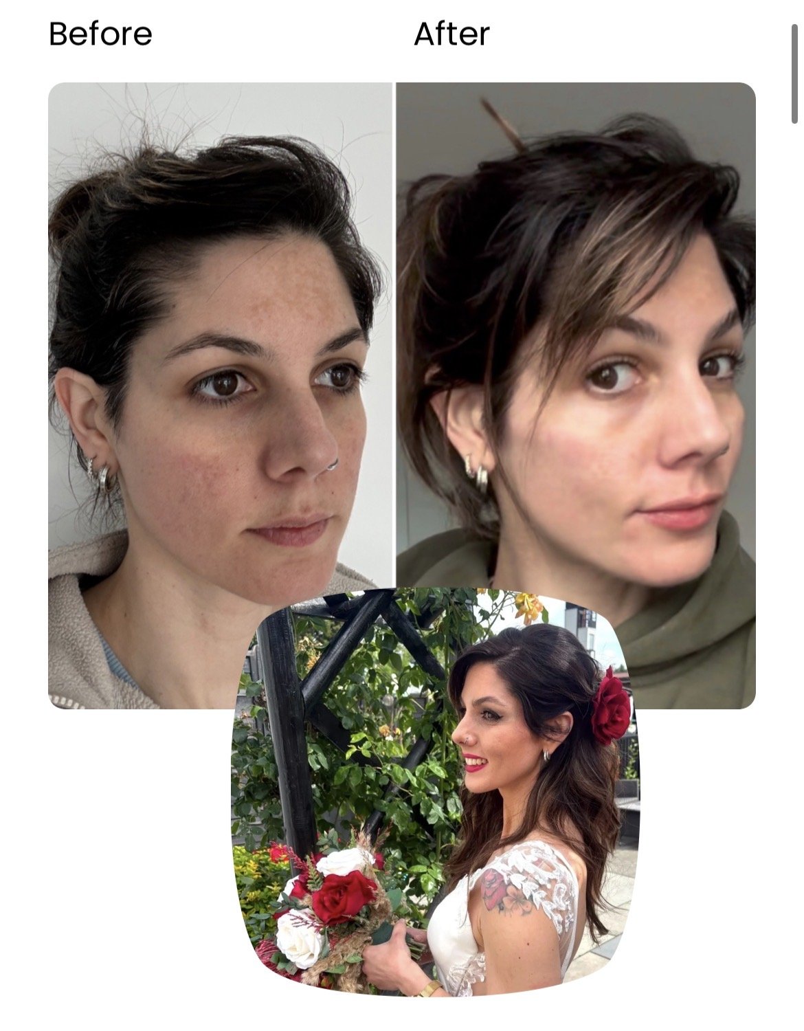 Comparison of a woman before and after a skincare treatment, and a separate photo of the same woman holding a bouquet of flowers, with visible facial improvements and styled hair.