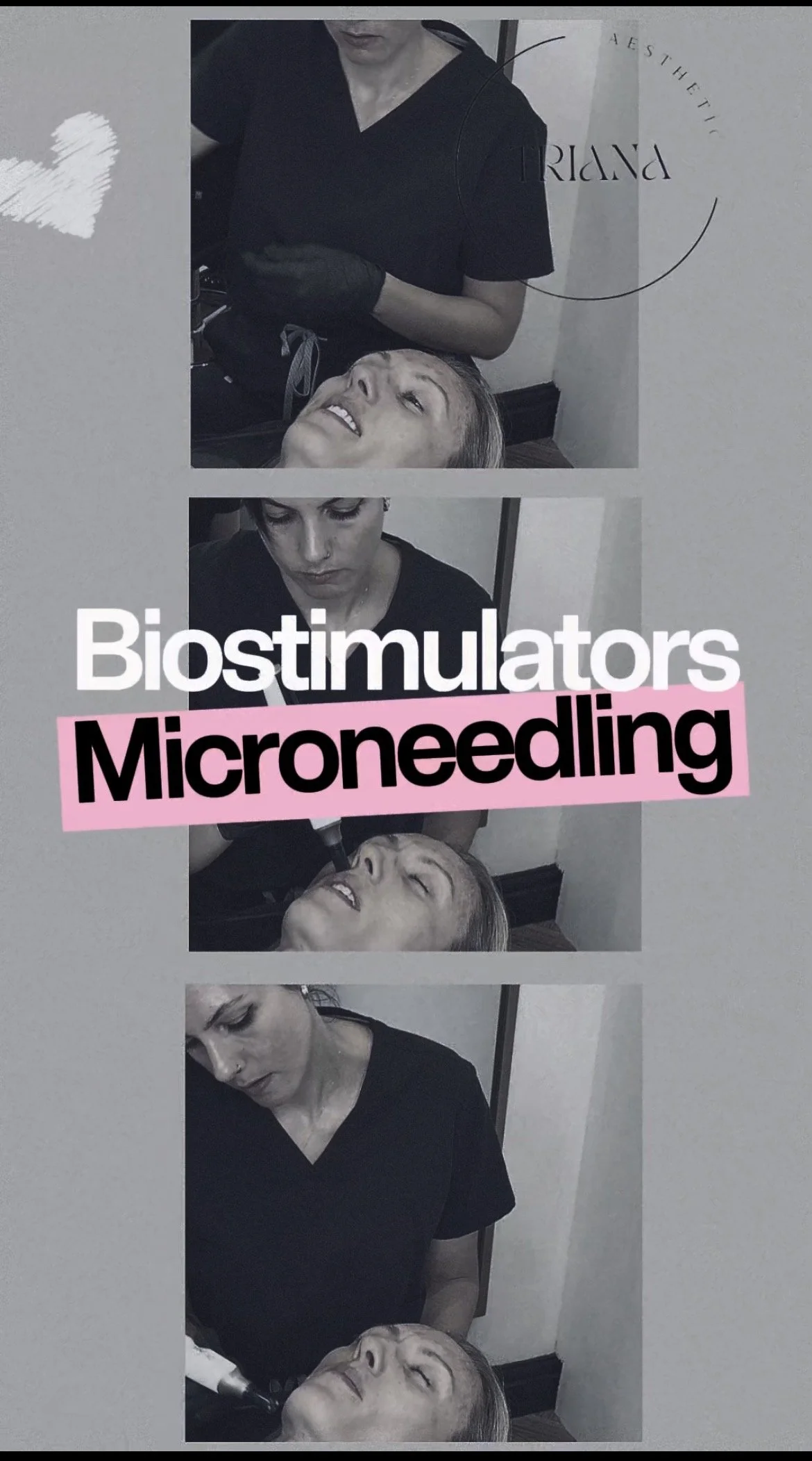 A sequence of black and white photos showing a woman receiving facial treatment with a microneedling device. The words 'Biostimulators Microneedling' are overlaid in large, bold text with a pink background.