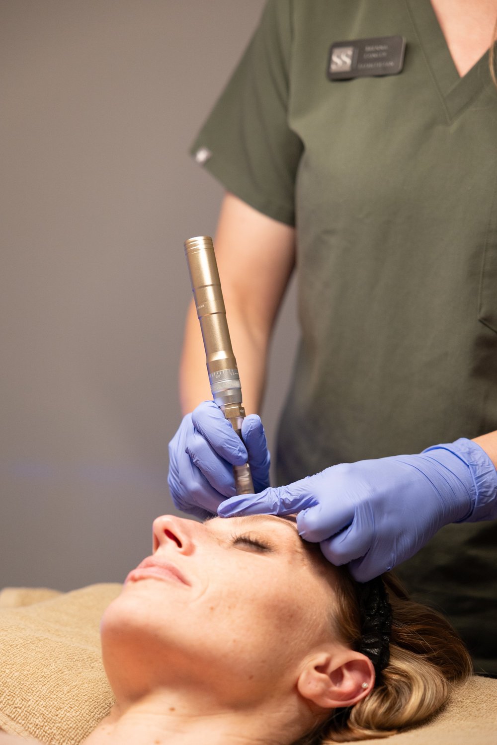 Microneedling