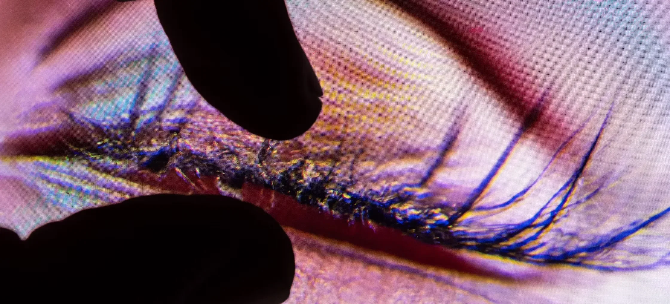 Close-up of a person's eye being examined with a specialized medical tool, showing detailed view of eyelashes, eyelid, and iris.