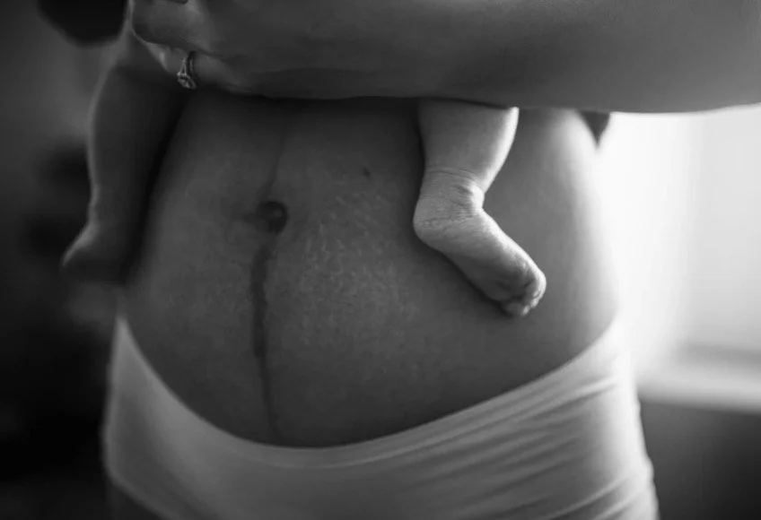 Lymphatic Detox & Scar Tissue healing