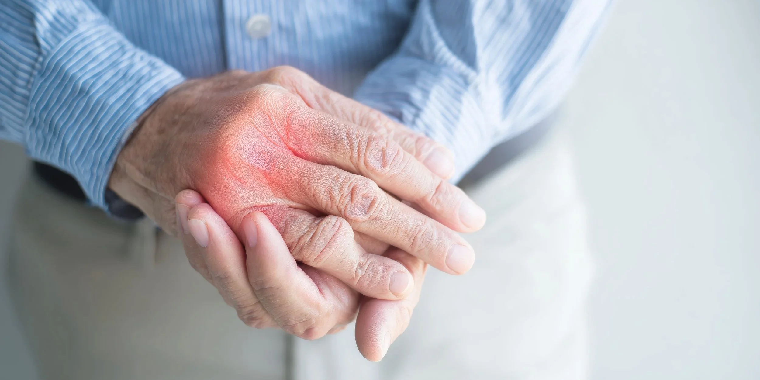 Close-up of a person's hand holding their other hand, which appears red and irritated, indicating possible pain or inflammation.