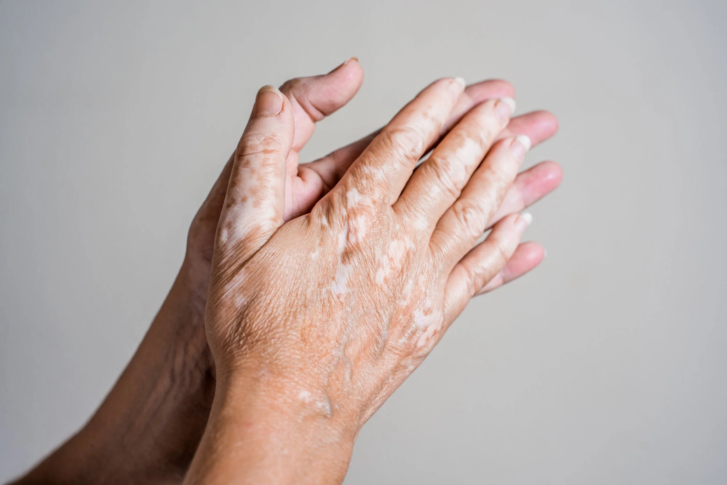 Close-up of two hands, one older with visible wrinkles and paint or lotion on the skin, the other younger, touching or holding the older hand against a plain background.