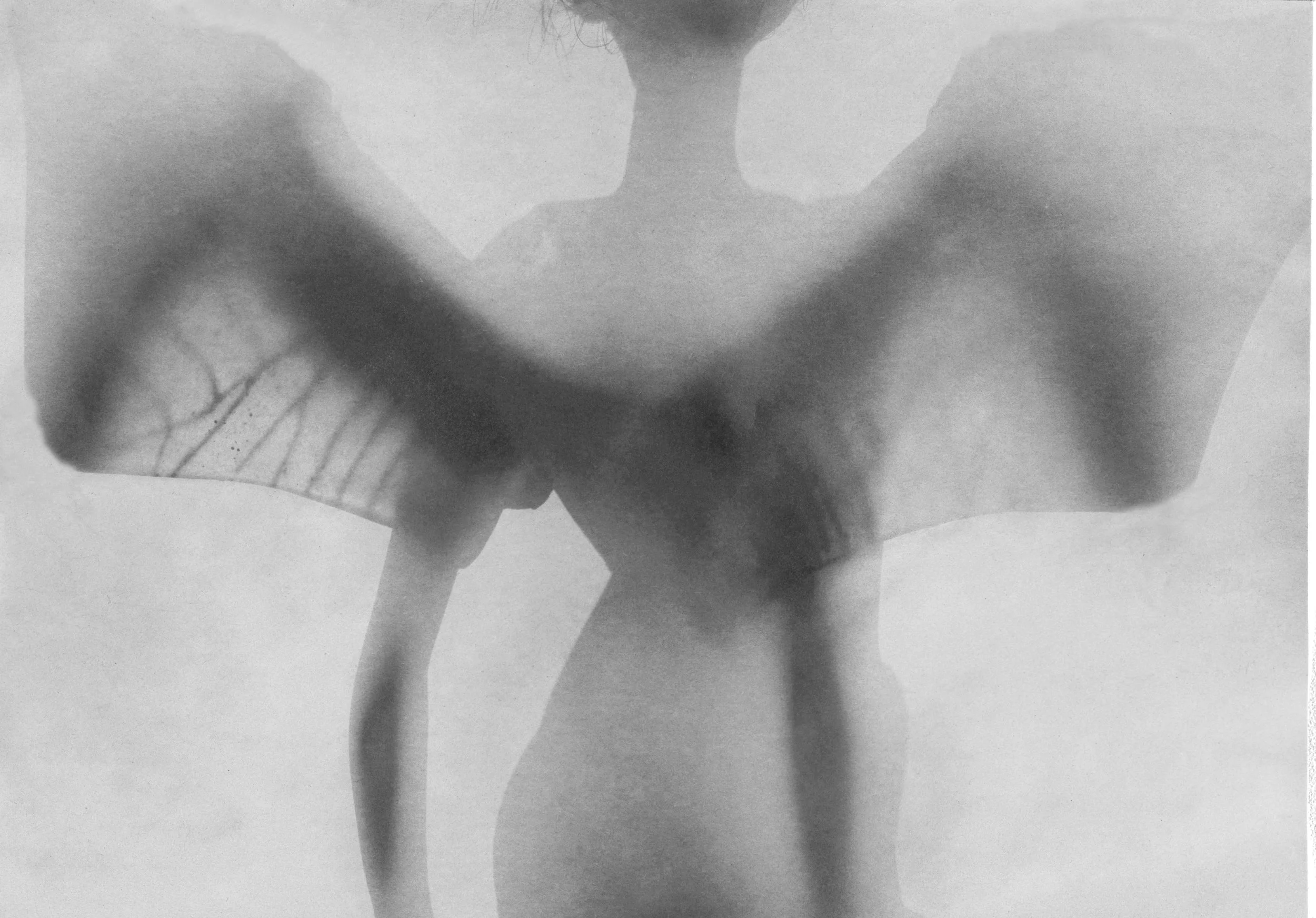 Black and white X-ray style image of a person's chest and arms, showing ribs and arm bones and wings