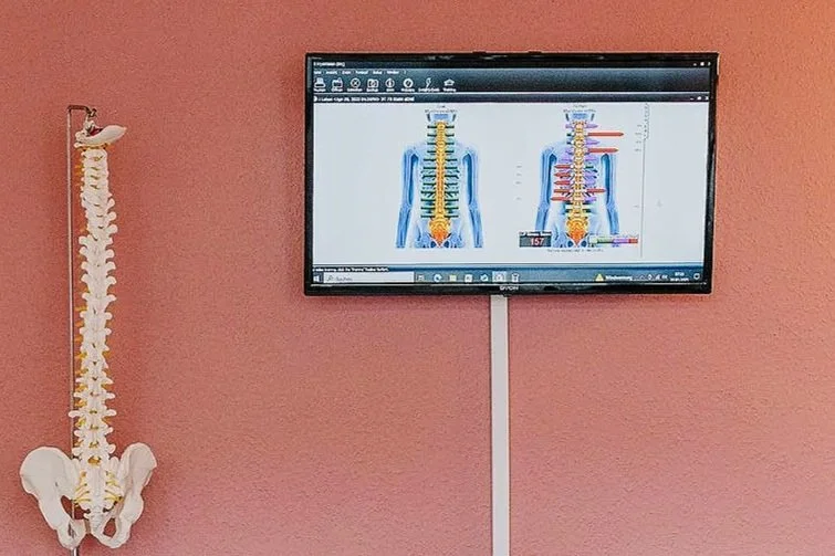 A medical illustration of the human spine displayed on a wall-mounted monitor, with a model of a human spine on a stand next to it.