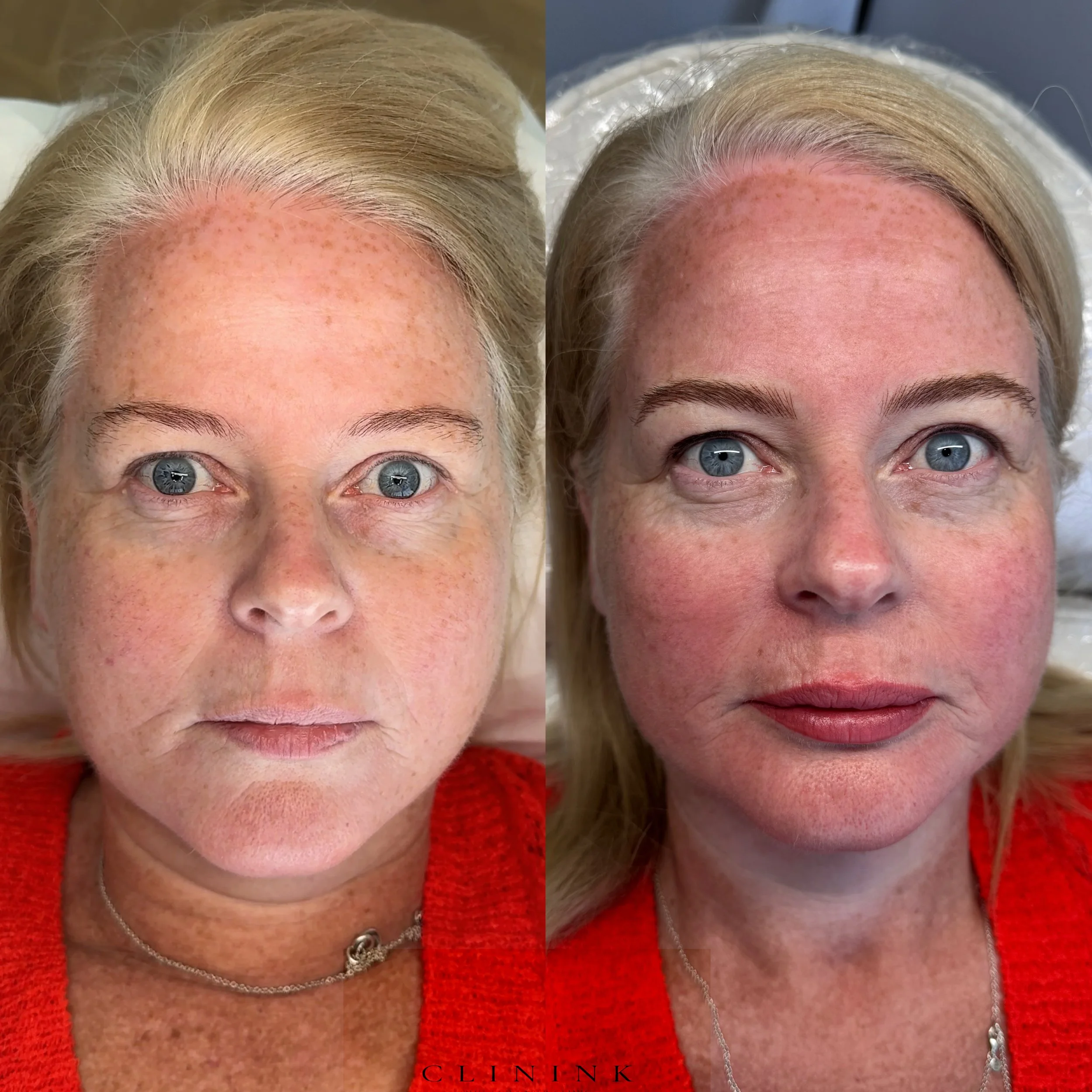 Side-by-side comparison of a woman before and after a full face permanent make up treatment