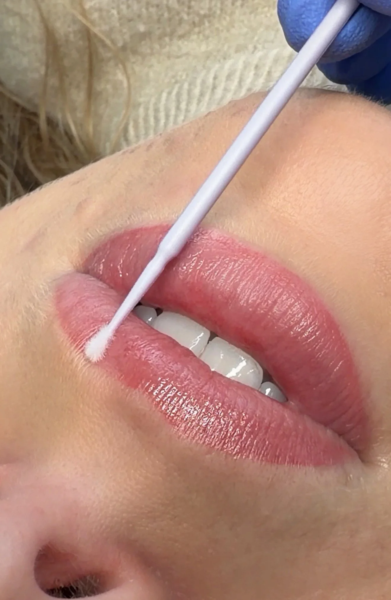 Showing healed lip blush results