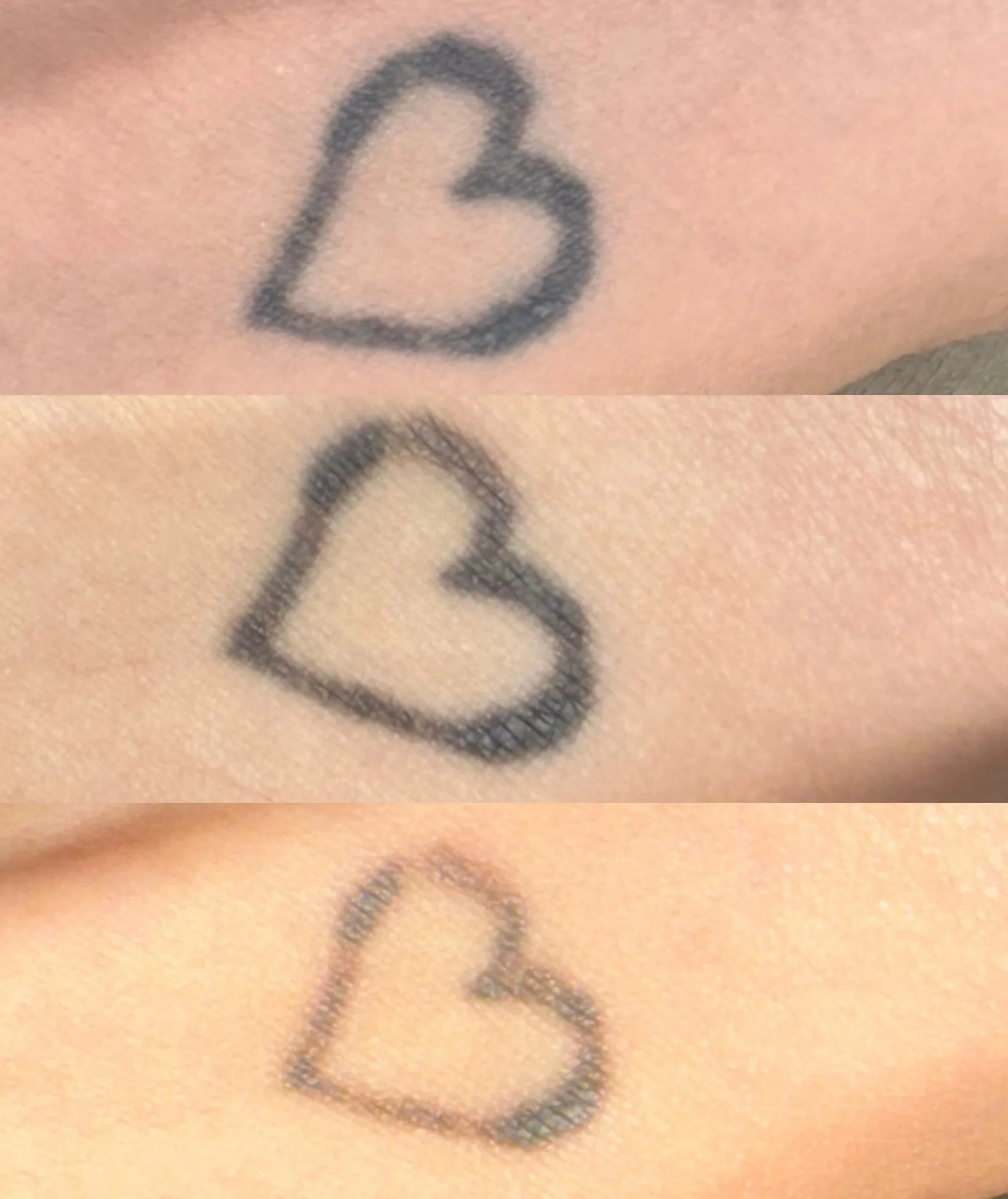A heart tattoo on skin with three different styles in a collage.