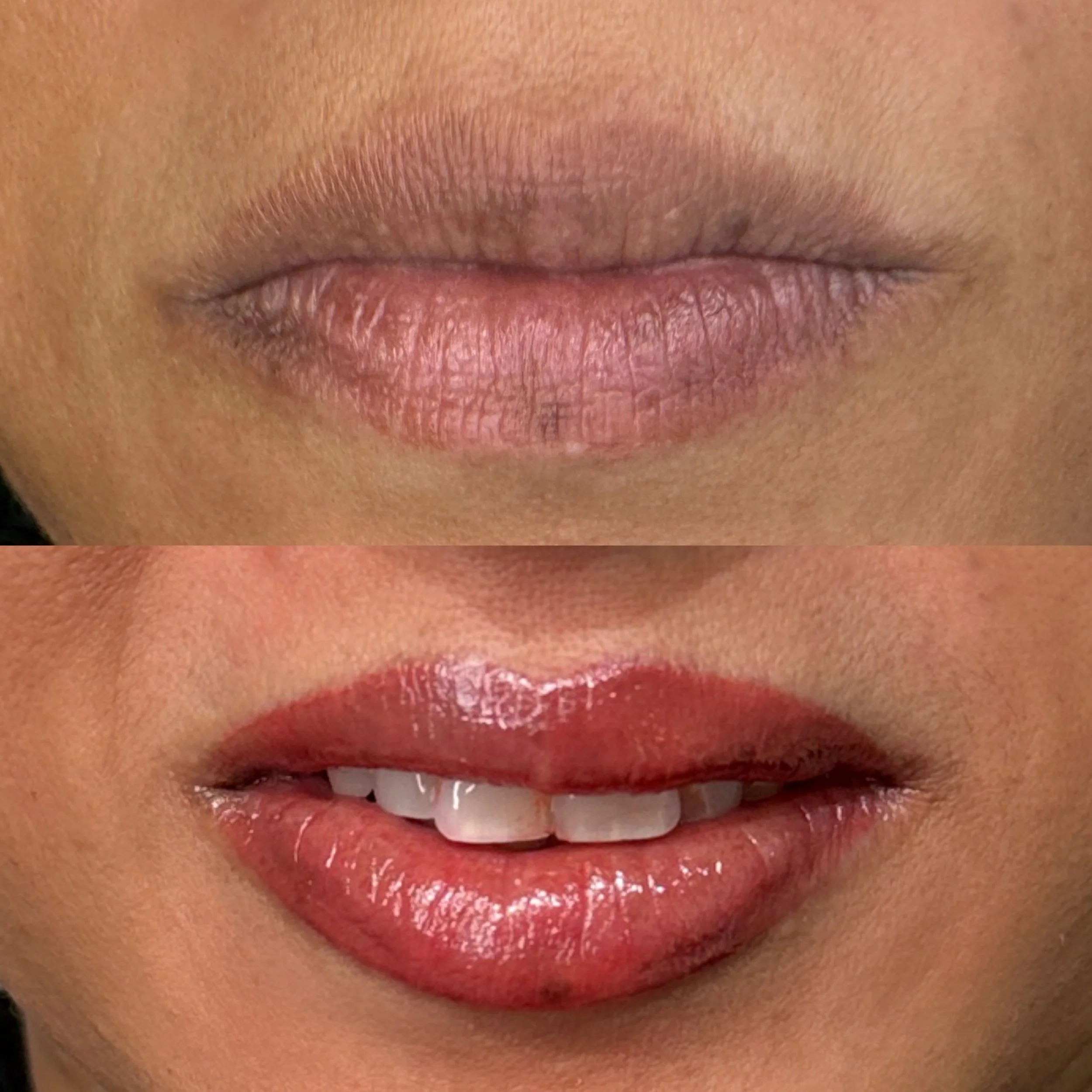 Close-up of a person's lips before and after lip neutralising treatment
