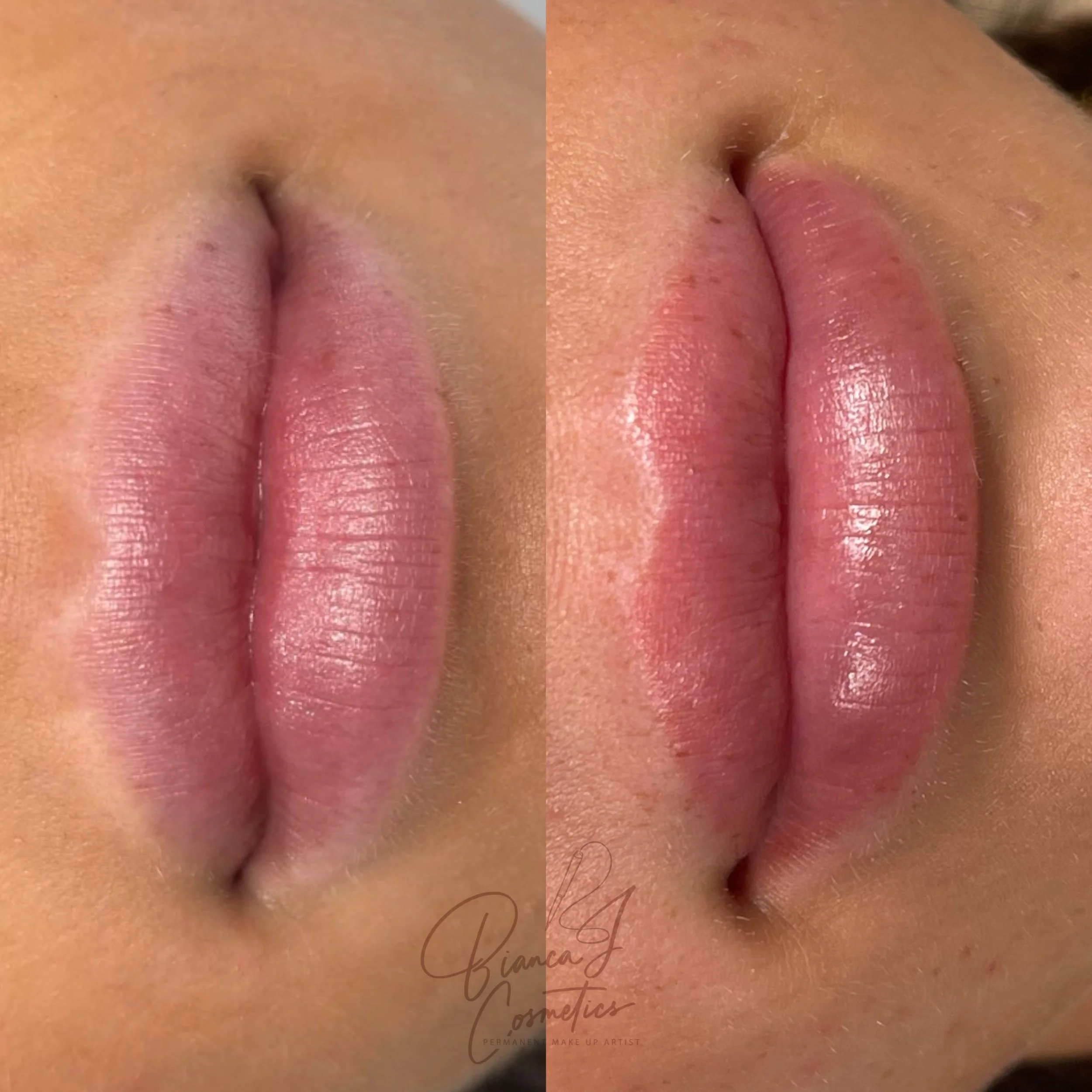 Close-up of lips before and healed results after cosmetic lip enhancement, showing improved fullness and smoothness.