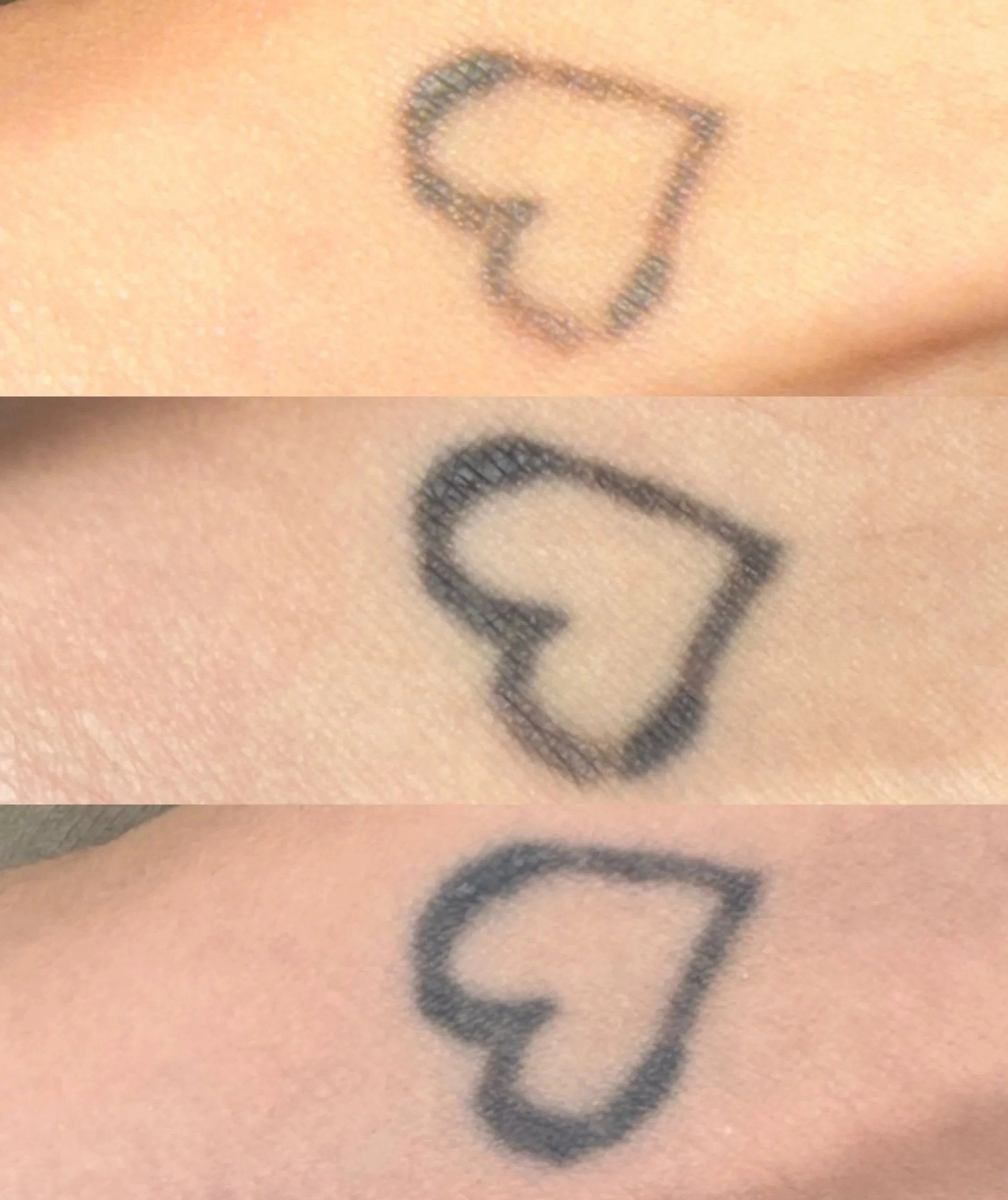 Close-up of a tattoo of a heart-shaped lock on skin, shown in three different slightly blurry images.