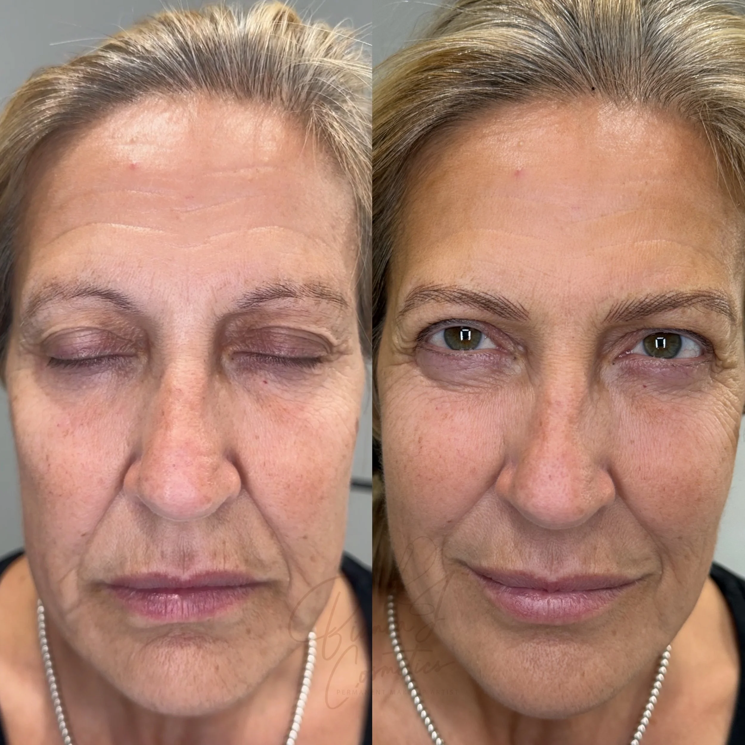 Side-by-side comparison of an older woman before and after a cosmetic procedure, with visible improvements in skin texture and appearance. Client has realism brow technique