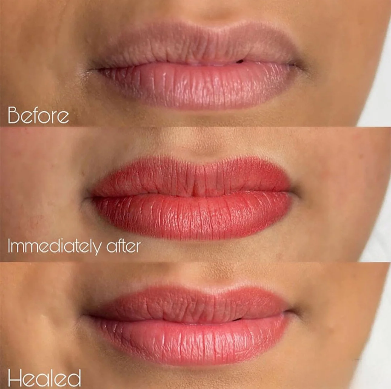 Close-up of lips showing before, immediately after, and healed lip blush tattoo