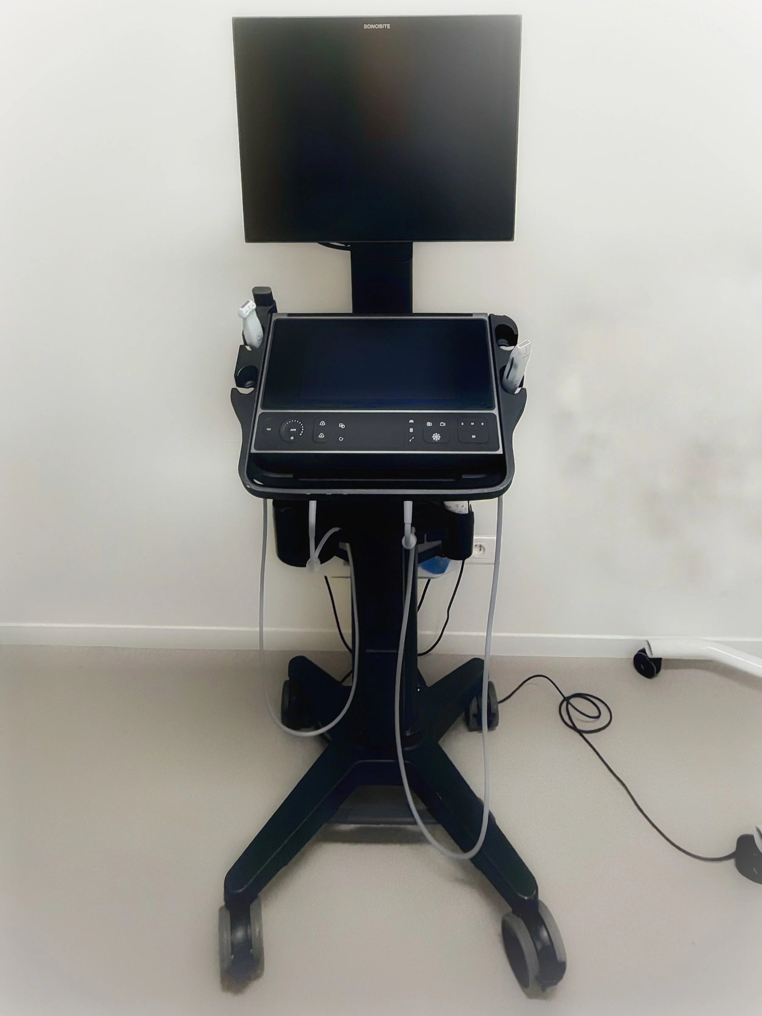 Sonde échographique ultra haute fréquence 46 MHz utilisée pour le bilan préopératoire en chirurgie lymphatique, Hospices Civils de Lyon