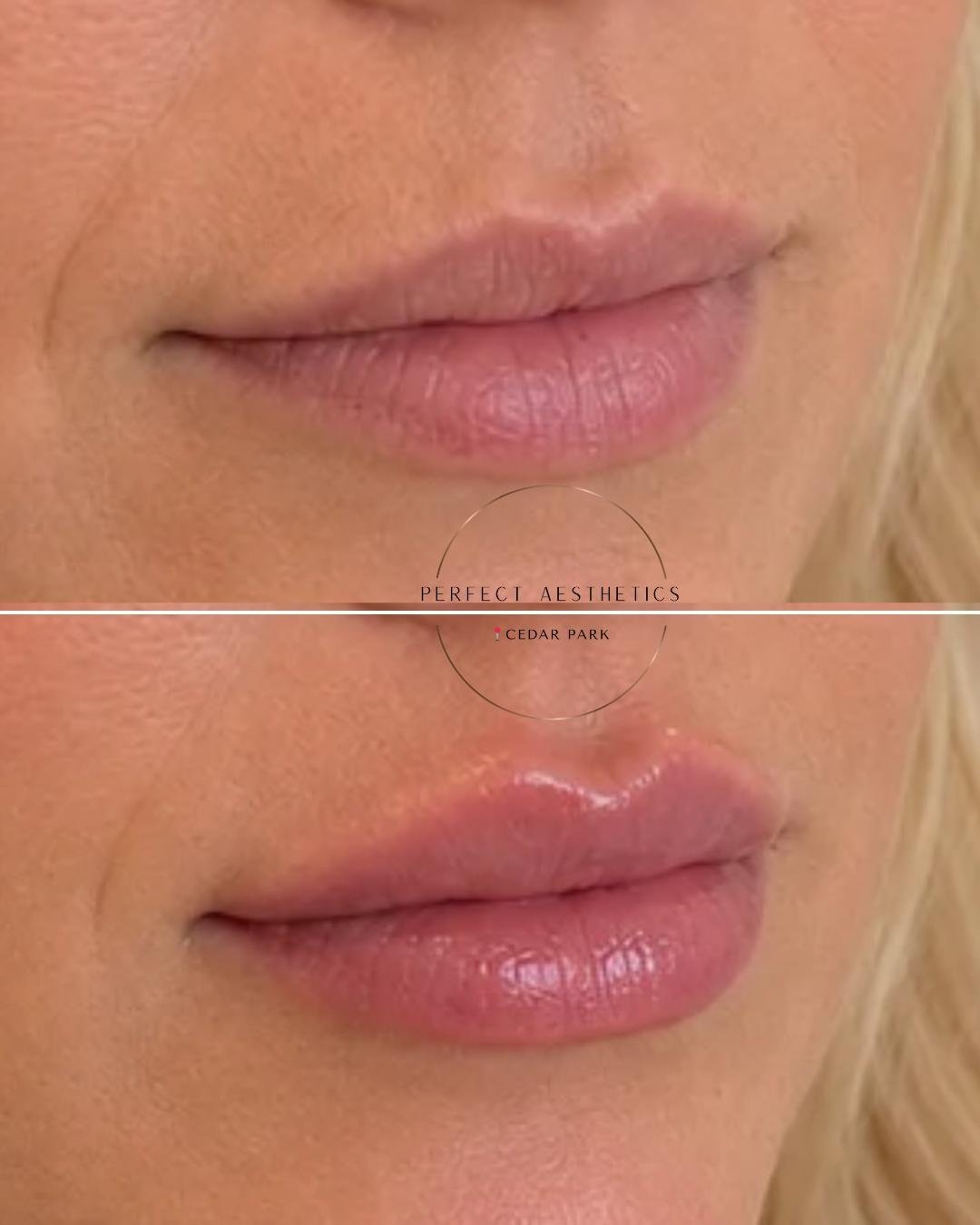 LIPS.jpeg