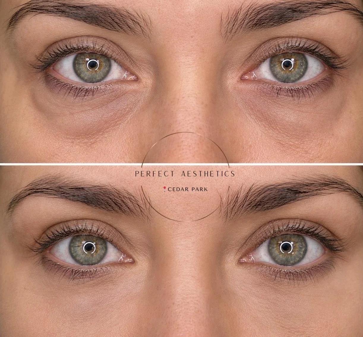 undereyegallery.jpeg