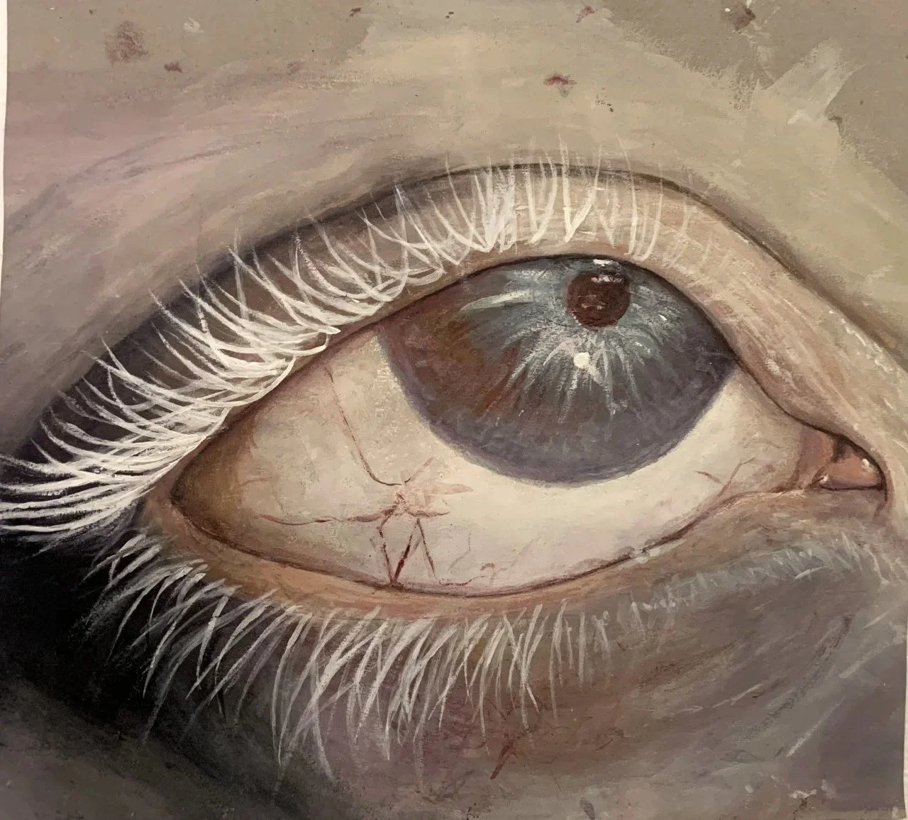 Eye 