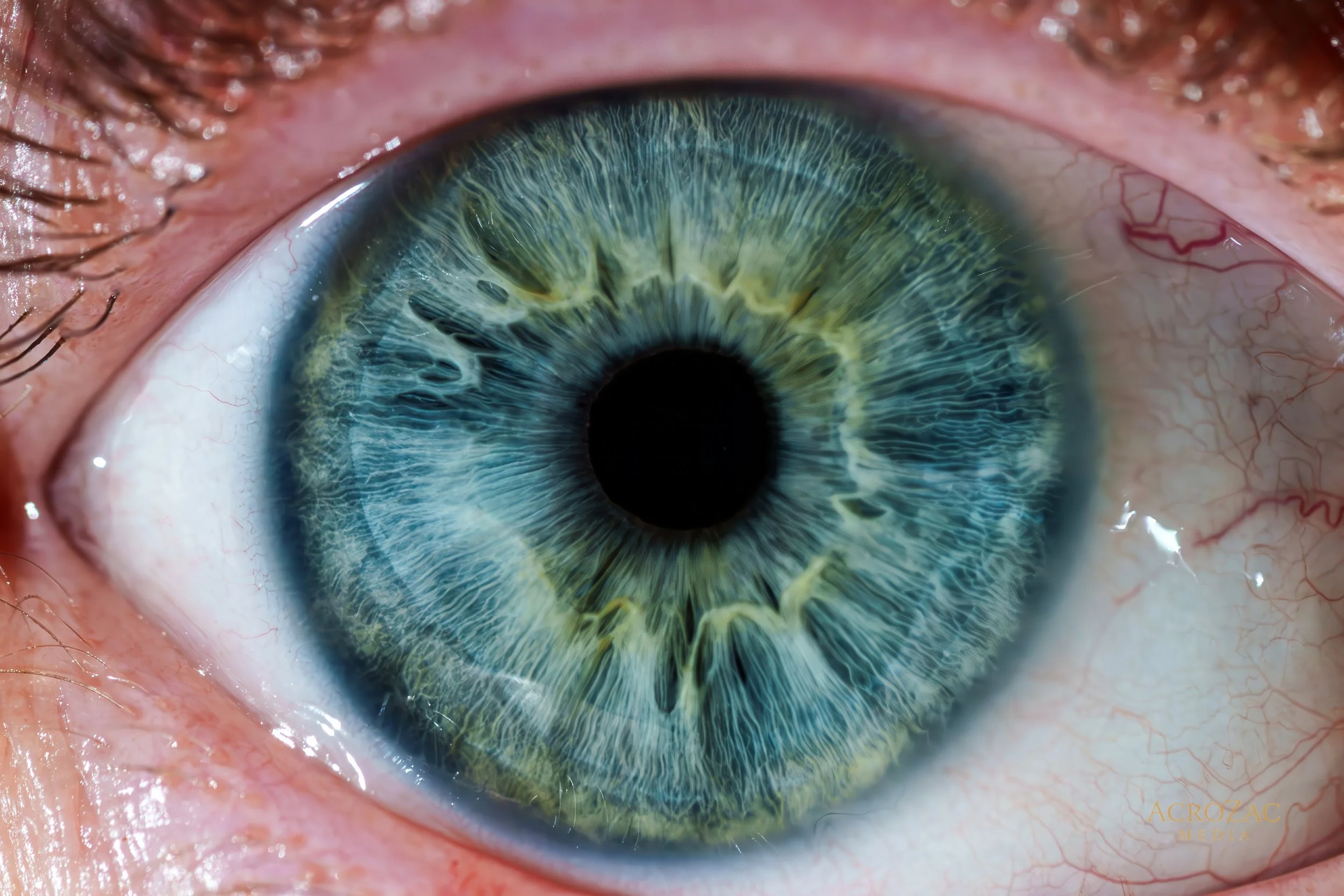 How Iris Photography Is Done