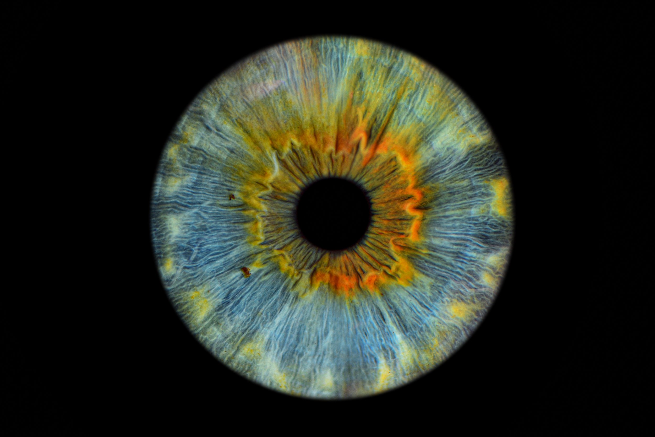 Close-up of a colorful human eye iris with intricate patterns and vibrant orange, yellow, and blue colors