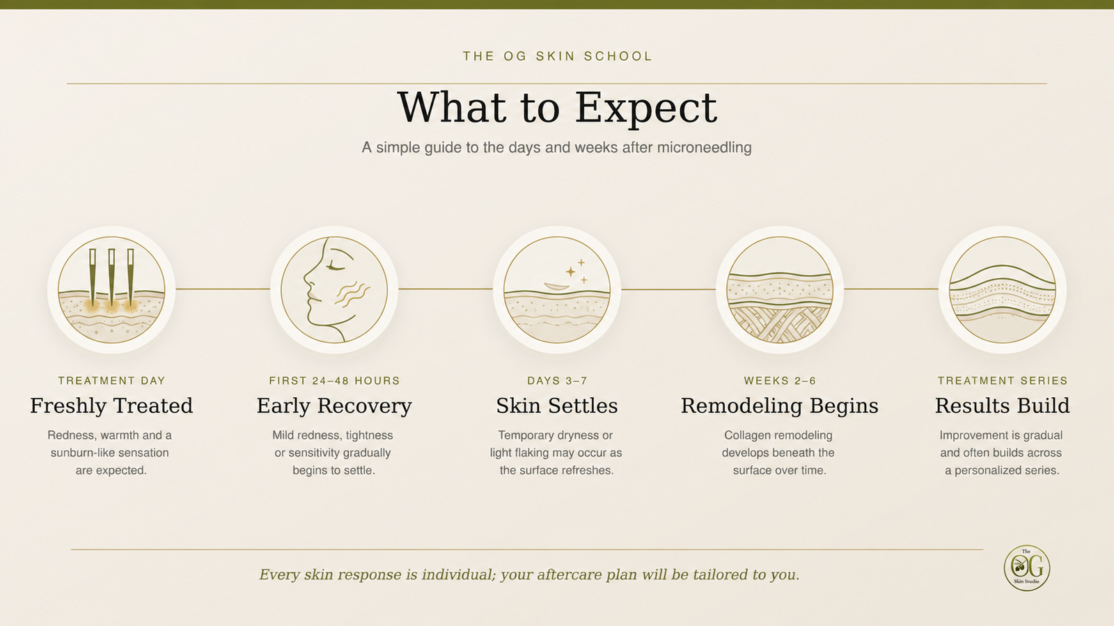 Timeline showing five stages after microneedling: freshly treated, early recovery, skin settles, remodeling begins, and results build