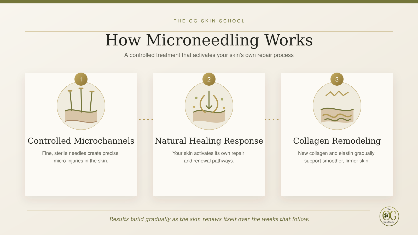 Diagram showing how microneedling works in three steps: controlled microchannels, natural healing response, and collagen remodeling