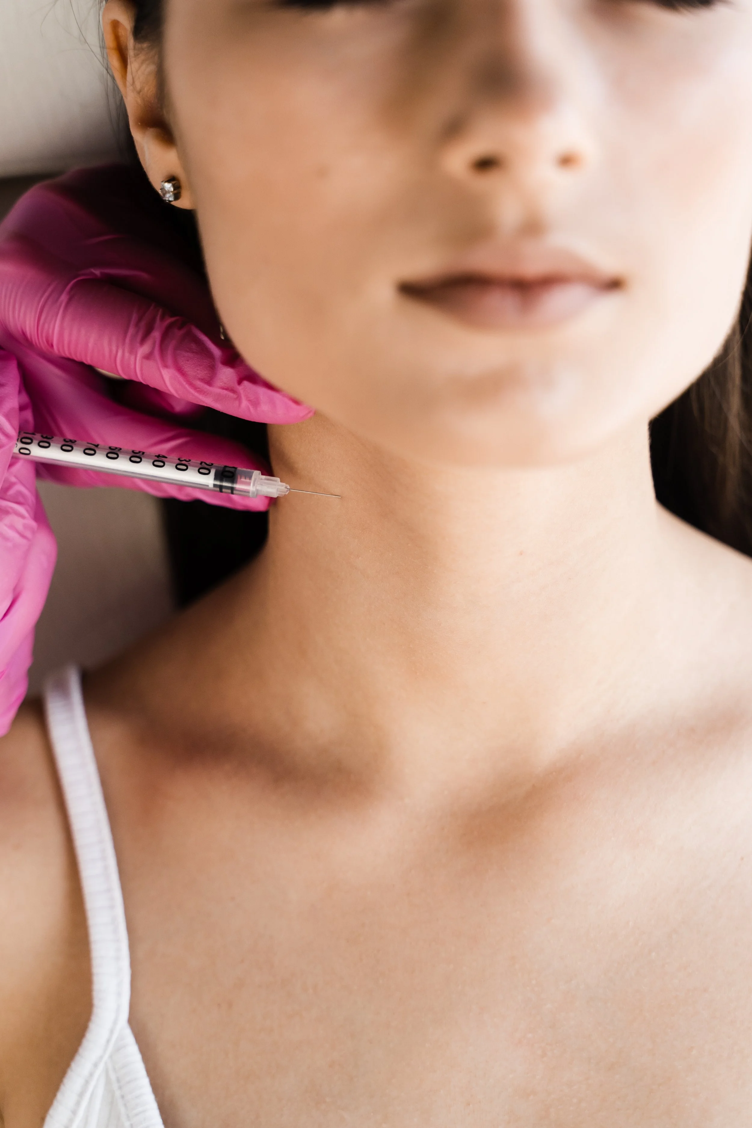 Profhilo Structura treatment at SkinFirst Warrington