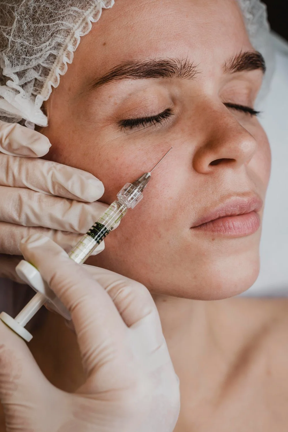 Profhilo treatment at SkinFirst Clinic in Warrington