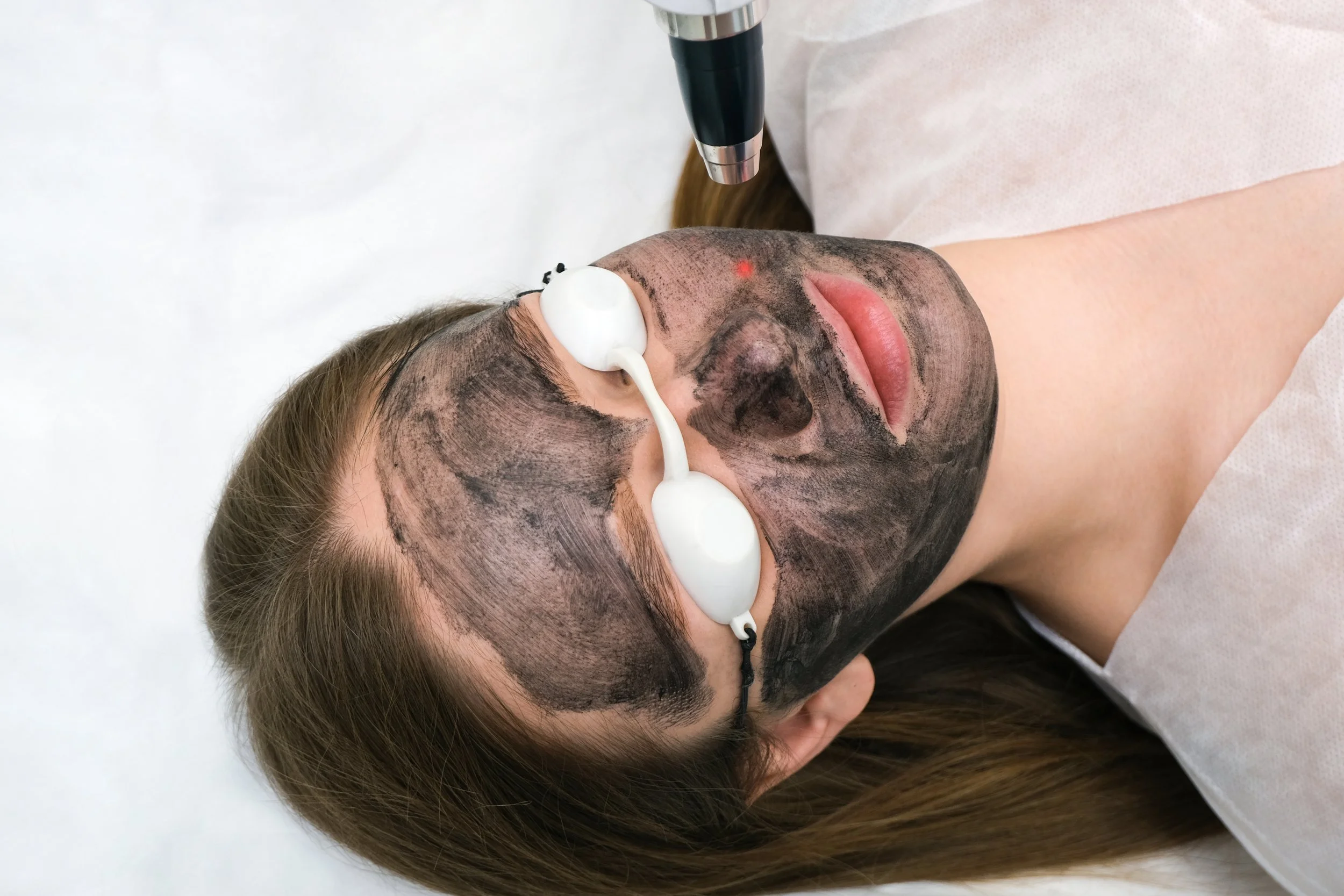 Carbon Facial treatment at SkinFirst Warrington