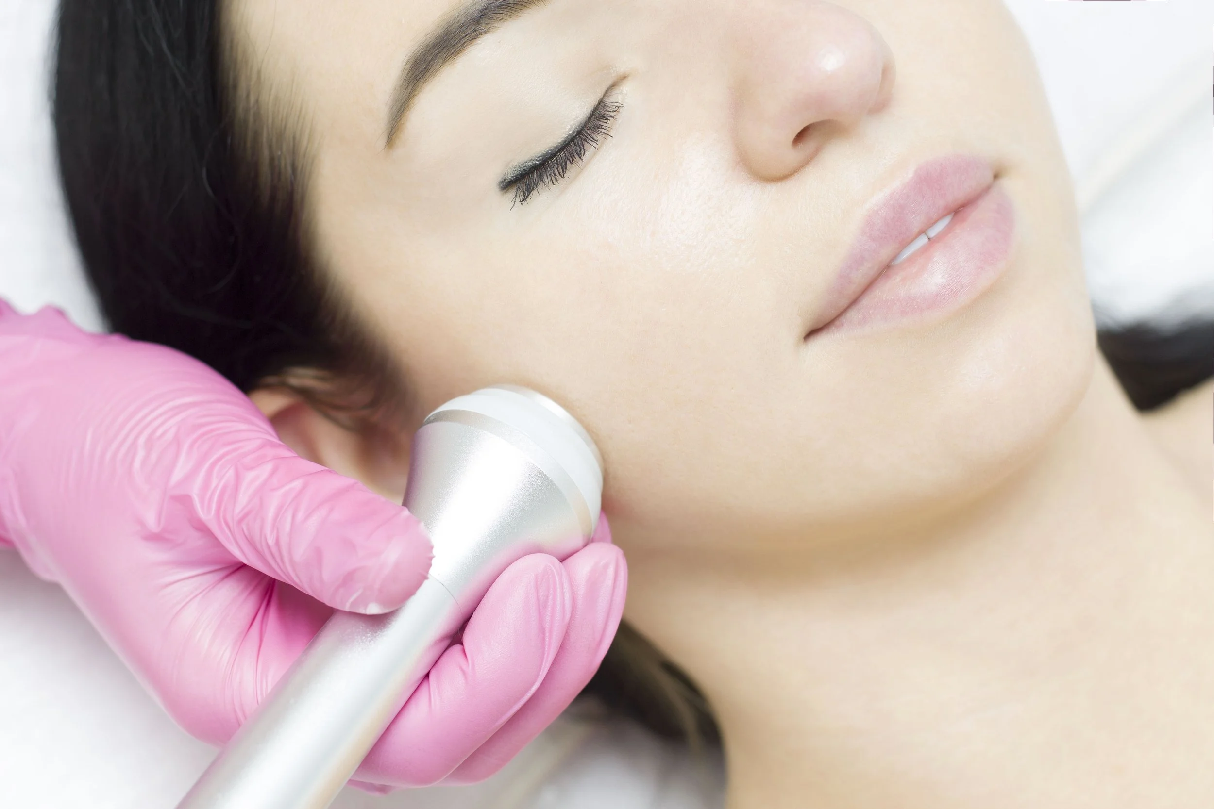 Radiofrequency skin tightening treatment at SkinFirst