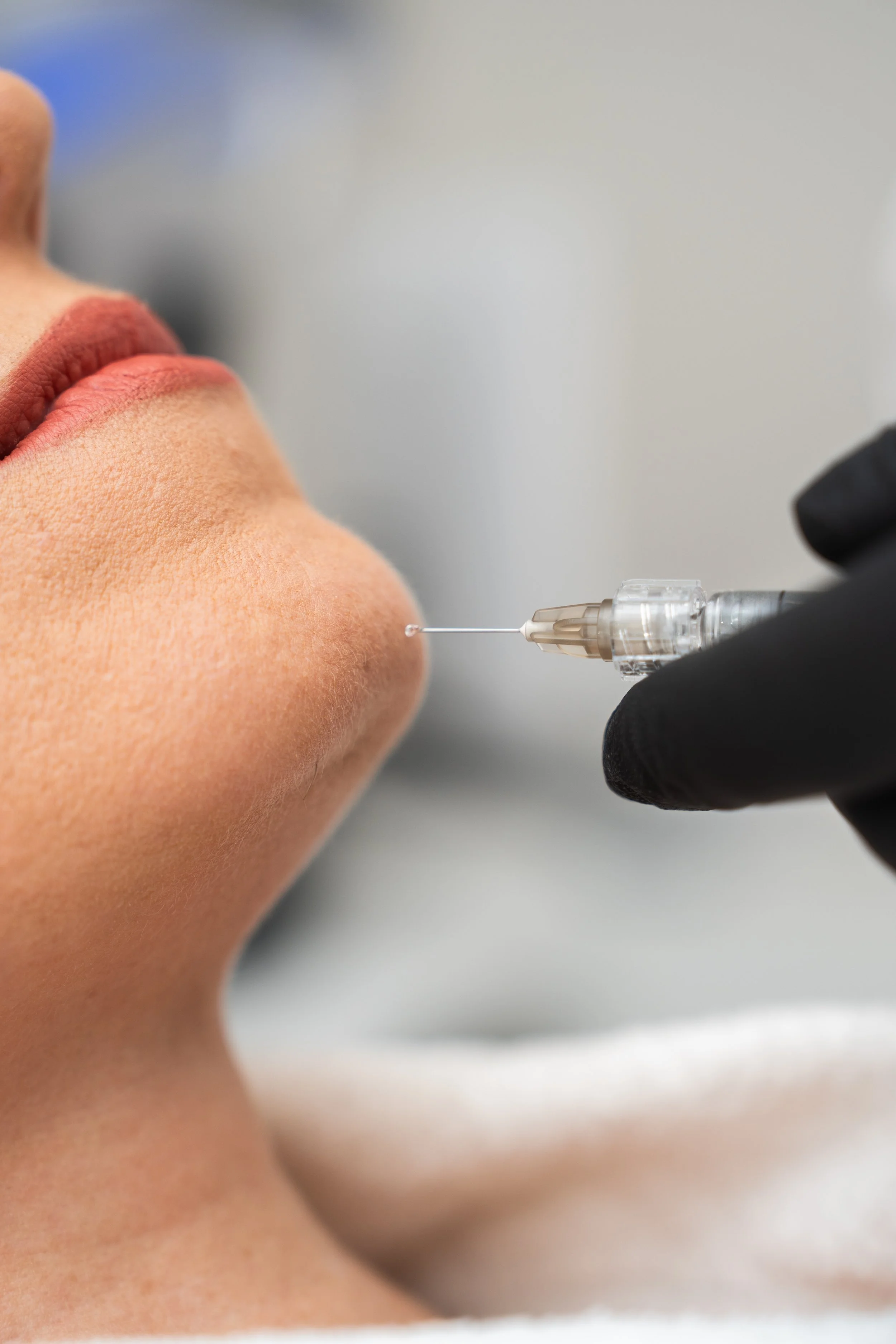 Profhilo Structura treatment for age related facial changes