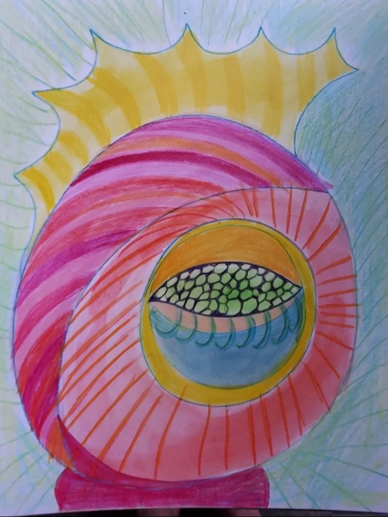 My Thing has pigment dispersion syndrome, which is this thing in my eye that makes the color part (the iris) flake off which causes the pressure inside my eye to go up which can cause glaucoma, which is a disease that can make me go blind. I take med