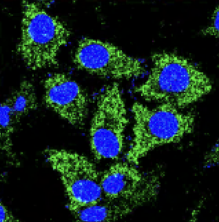 Fluorescent microscopy image of cells with blue nuclei and green cytoskeletons captured in our lab.