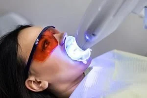 TEETH WHITENING