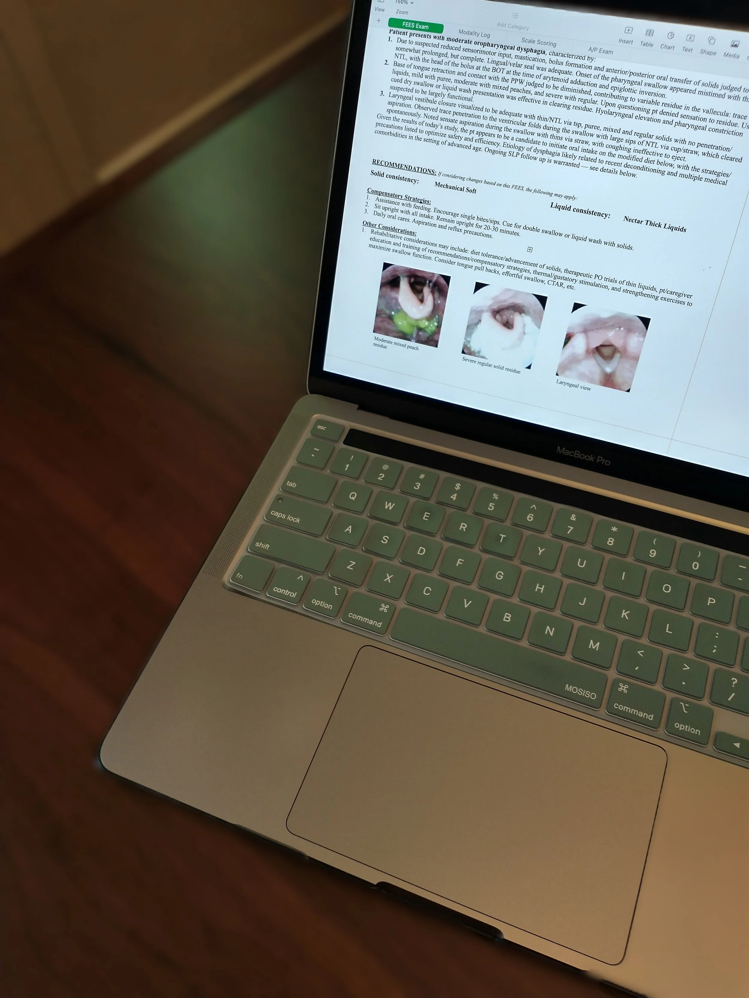 A MacBook Pro laptop on a wooden surface displaying a medical document with images and text.