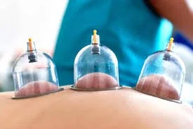 Myofascial Cupping