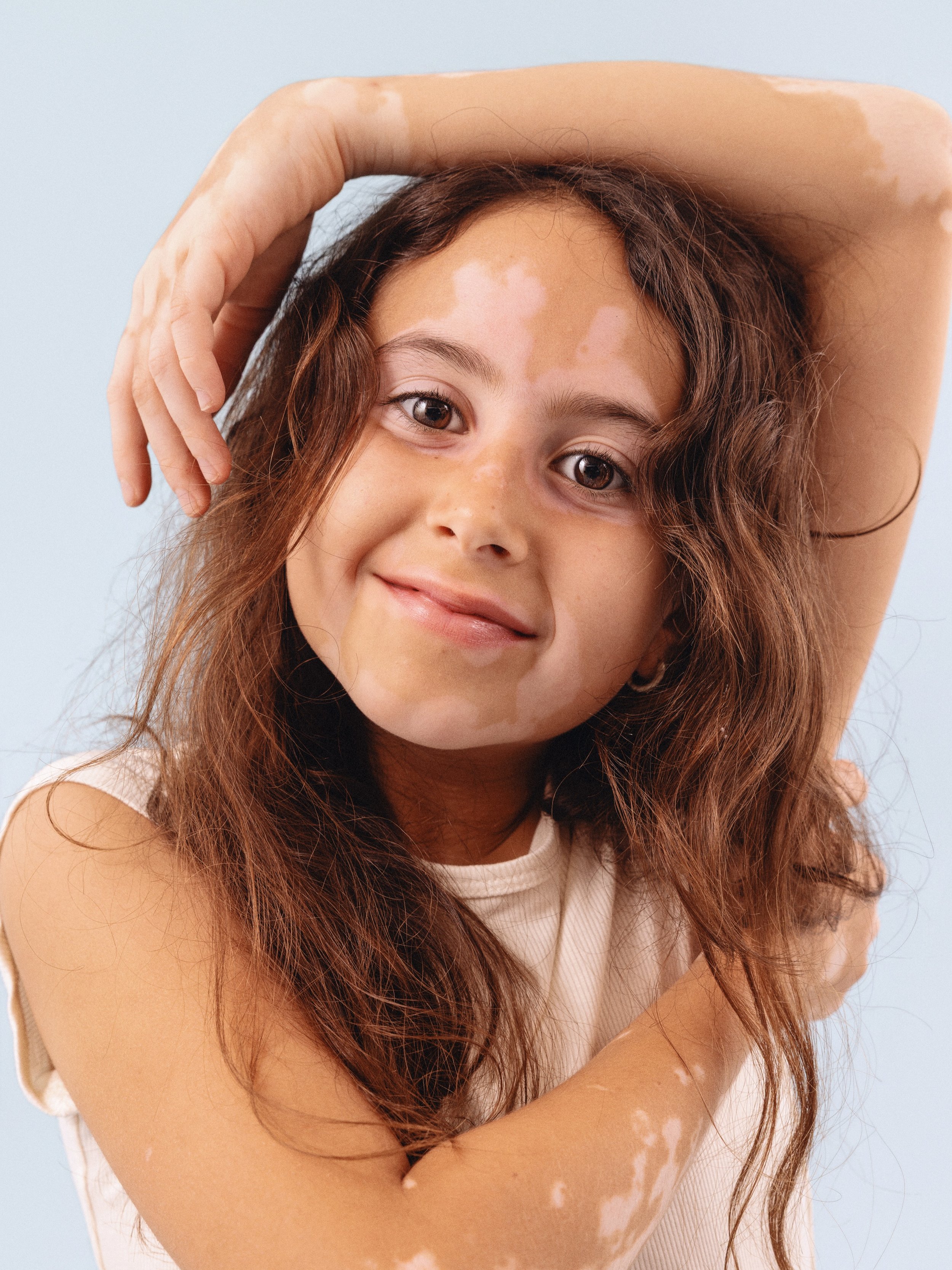 For Vitiligo Awareness Month, we want to introduce you to Avery &mdash; our daughter, our co-author, and the heart behind What Makes You&hellip; YOU! And @averysreadingnook 

Avery was 5 when she started developing vitiligo. It first appeared in smal