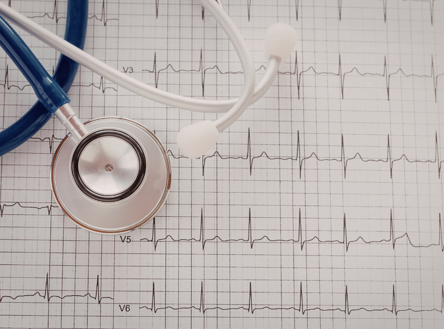 Electrocardiogram printout with a stethoscope placed on top, showing multiple heartbeats.