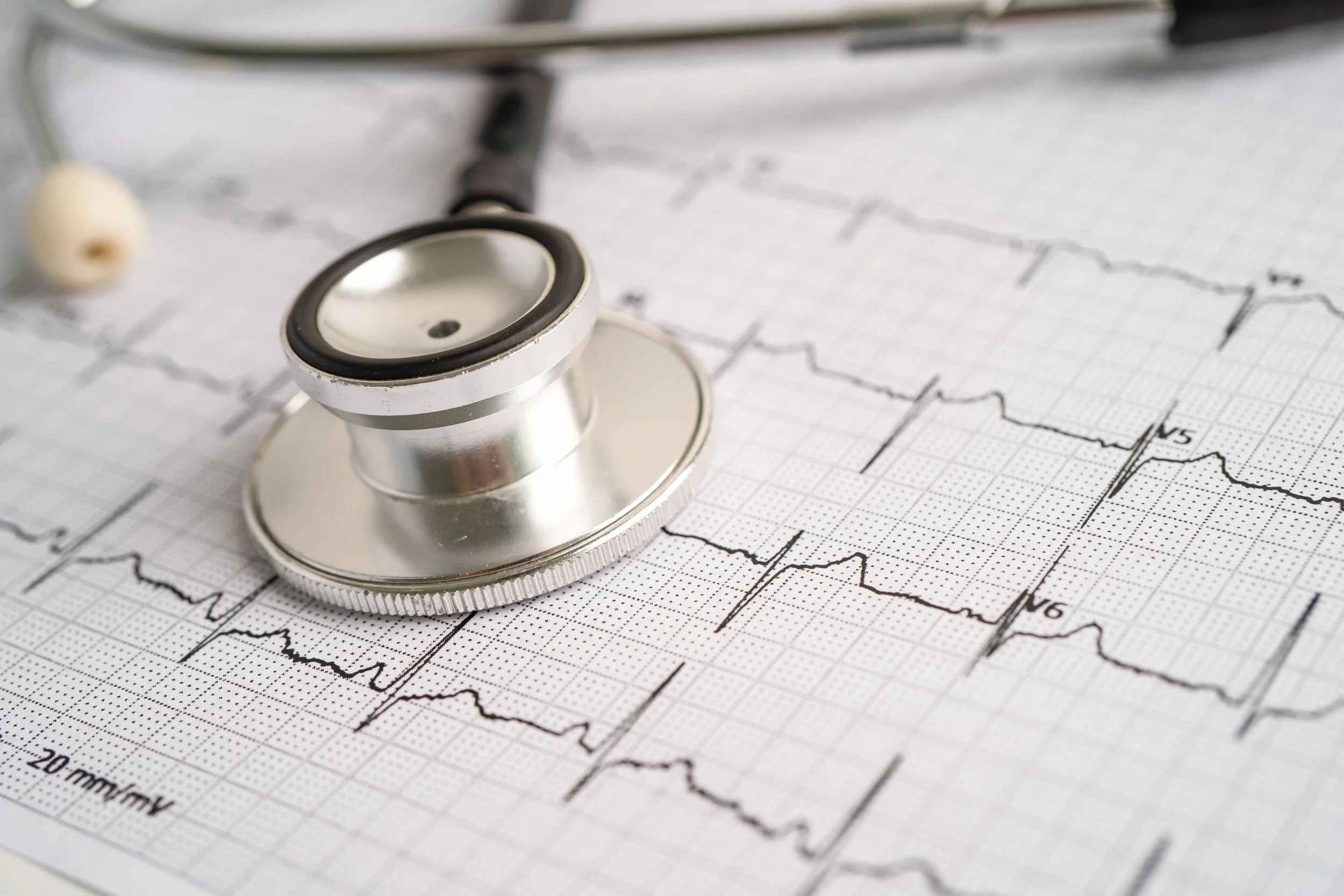 Stethoscope placed on an electrocardiogram (ECG) graph.