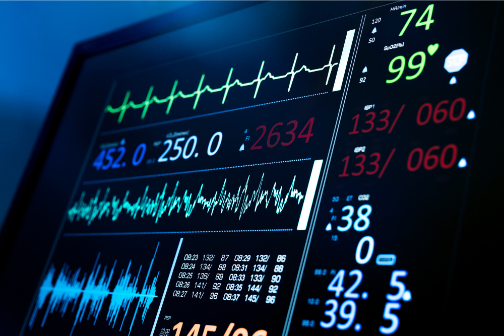 Medical monitor displaying vital signs including heart rate, blood pressure, oxygen saturation, and respiratory rate.