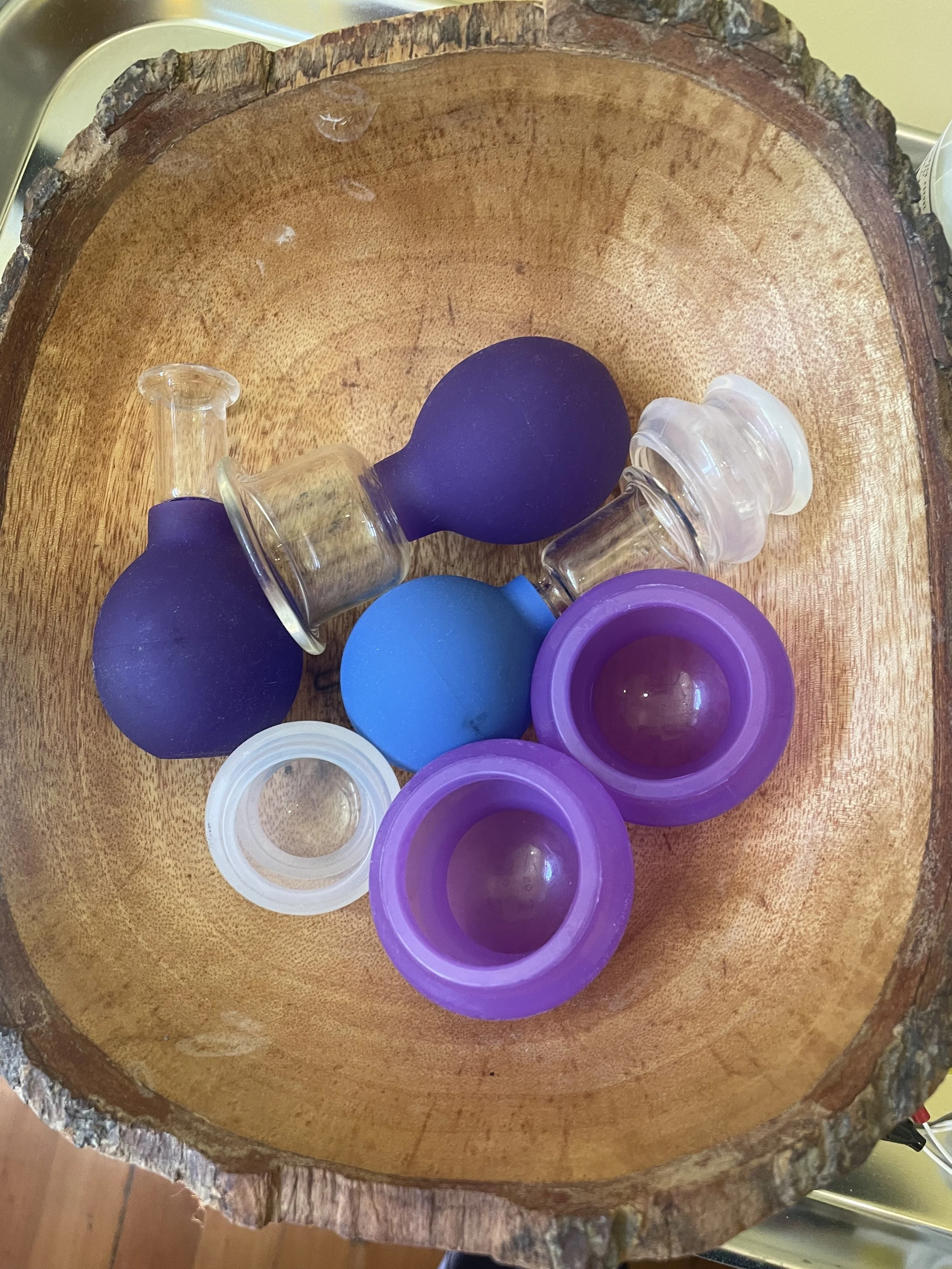 Curious about Fire Cupping?