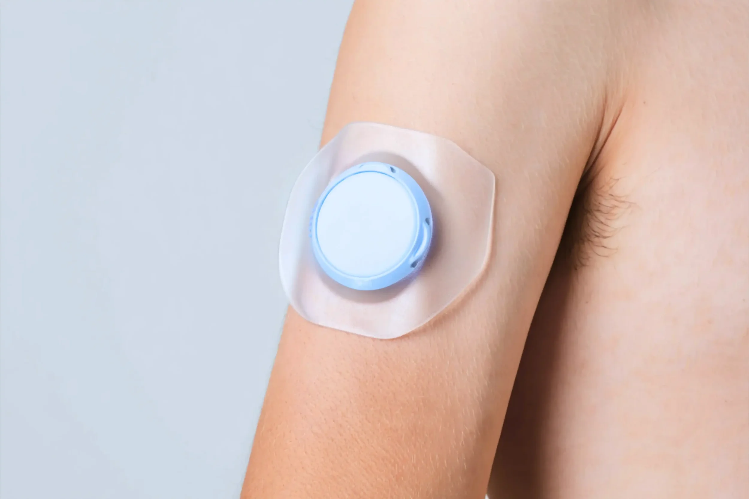 A close-up of a person's upper arm with a medical adhesive patch and round white device attached to the skin.