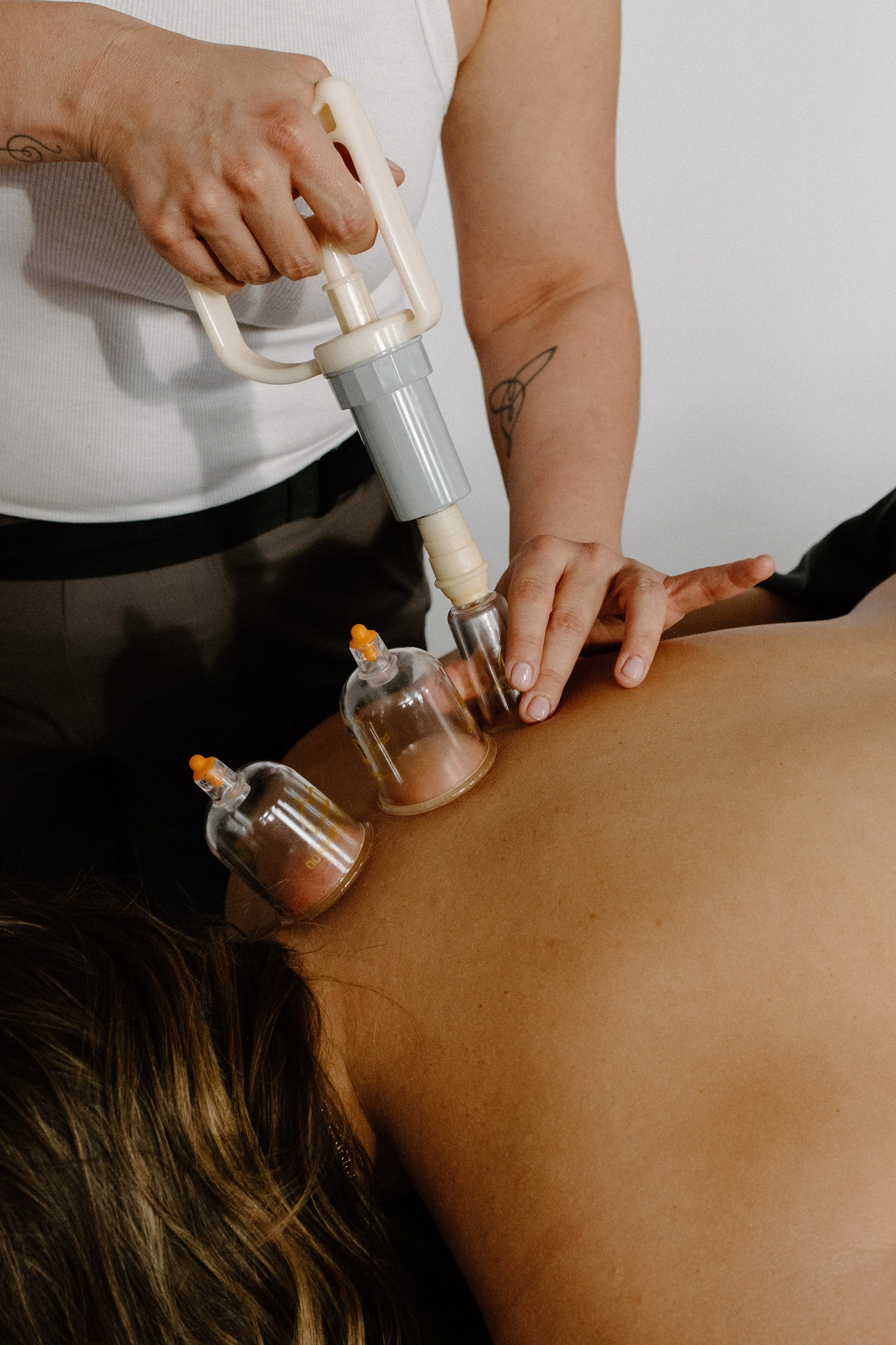 A massage therapist using a cupping technique to a client's back.