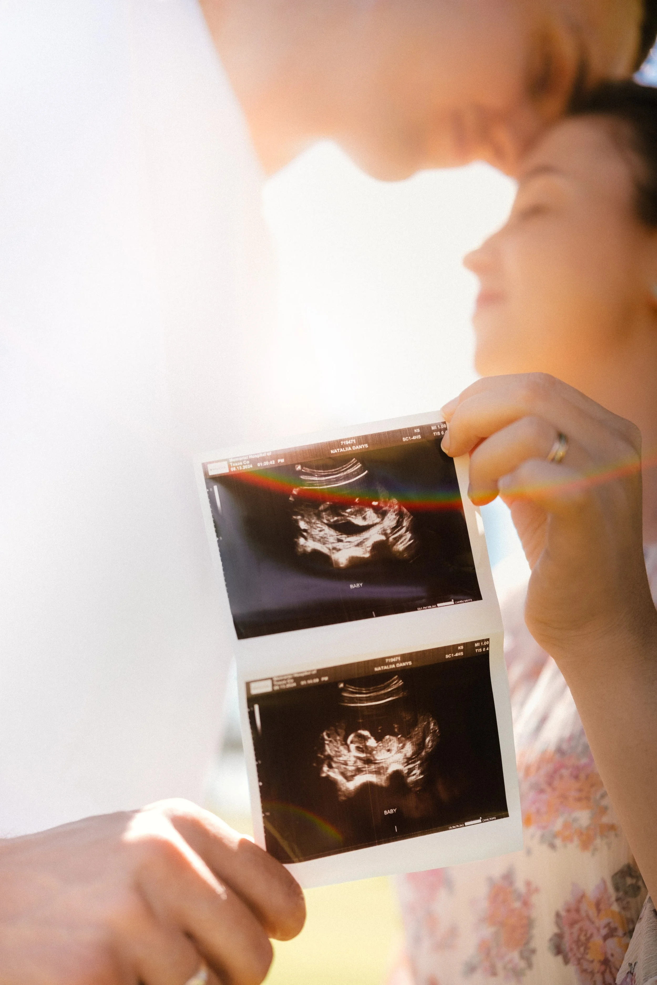 Close-up of a woman holding ultrasound images, possibly at a medical appointment or ultrasound session.